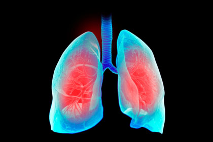 lung