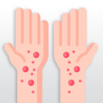 Skin Diseases